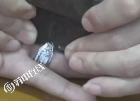 徐州小伙被戒咬宜兴消防巧拆除
